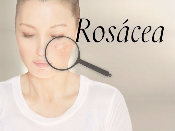 Rutina facial pieles rosáceas: MADE in TRIBE